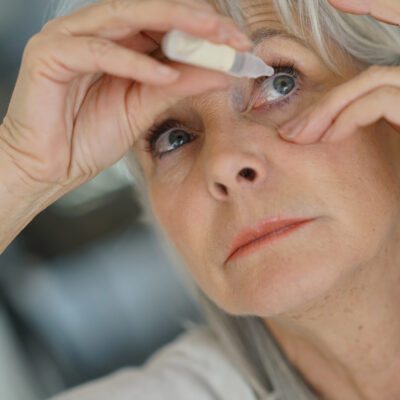 5 Ways to Cure Dry Eyes Naturally