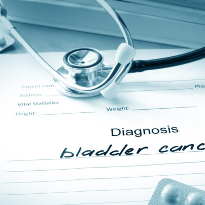 Bladder Cancer: Causes and Treatments