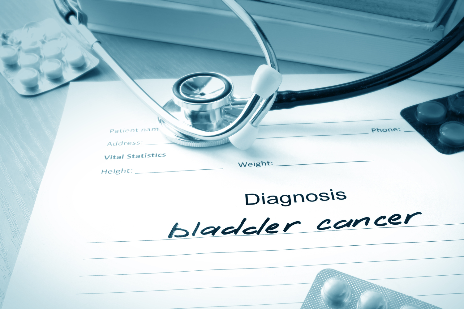 Bladder Cancer: Causes and Treatments