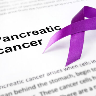 How to Reduce the Risk of Pancreatic Cancer