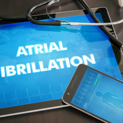 Treatment options for atrial fibrillation