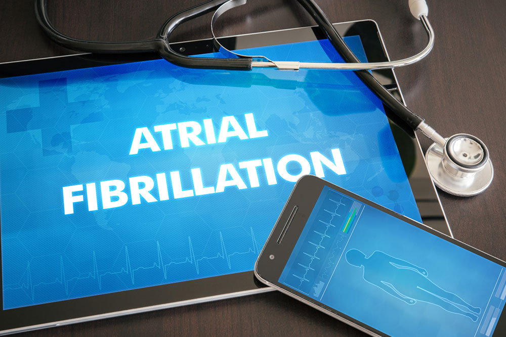 Treatment options for atrial fibrillation