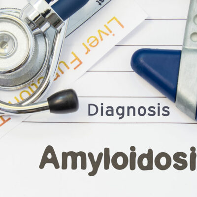 Types of Amyloidosis and Their Effects