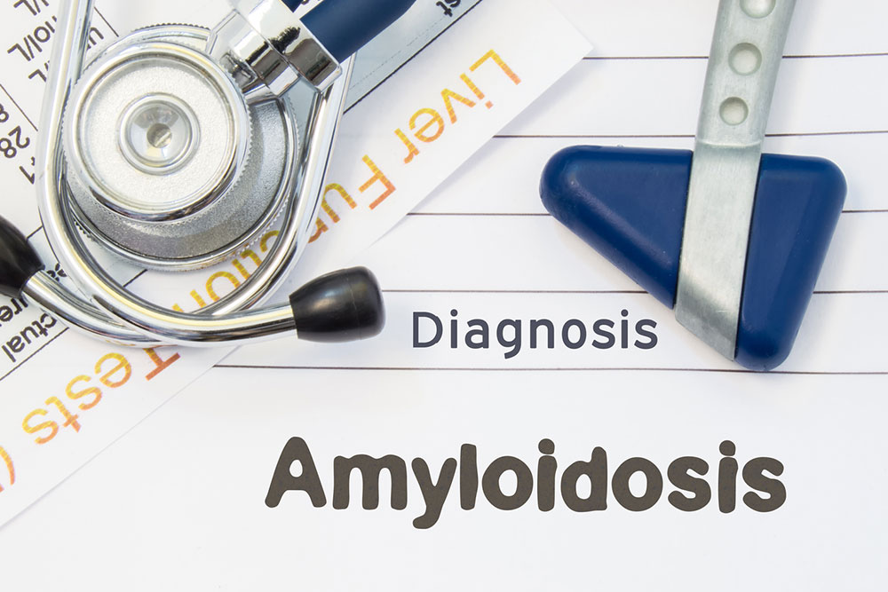 Types of Amyloidosis and Their Effects