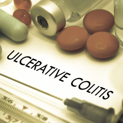 Types, Symptoms, and Risk Factors for Ulcerative Colitis