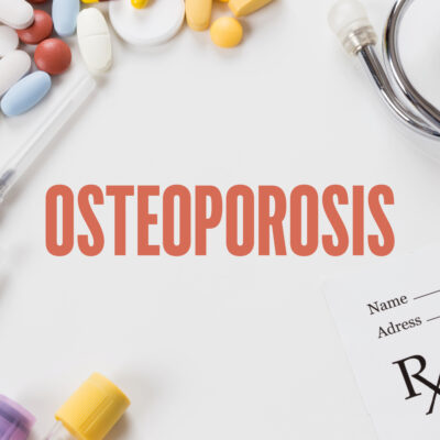 Osteoporosis: Symptoms and Treatments